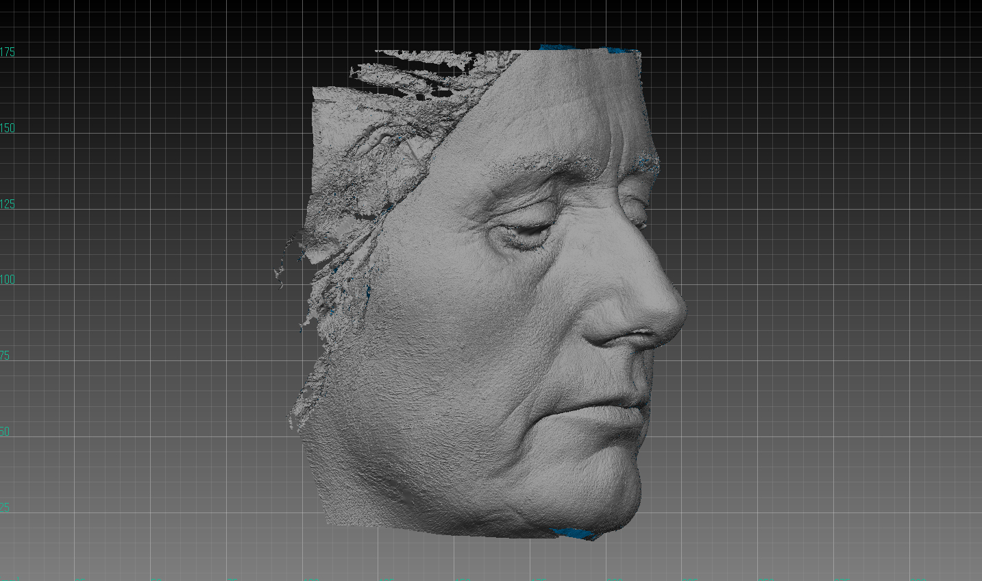 顔全体の3次元画像
