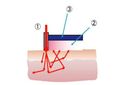 肌の中の光の散乱と吸収