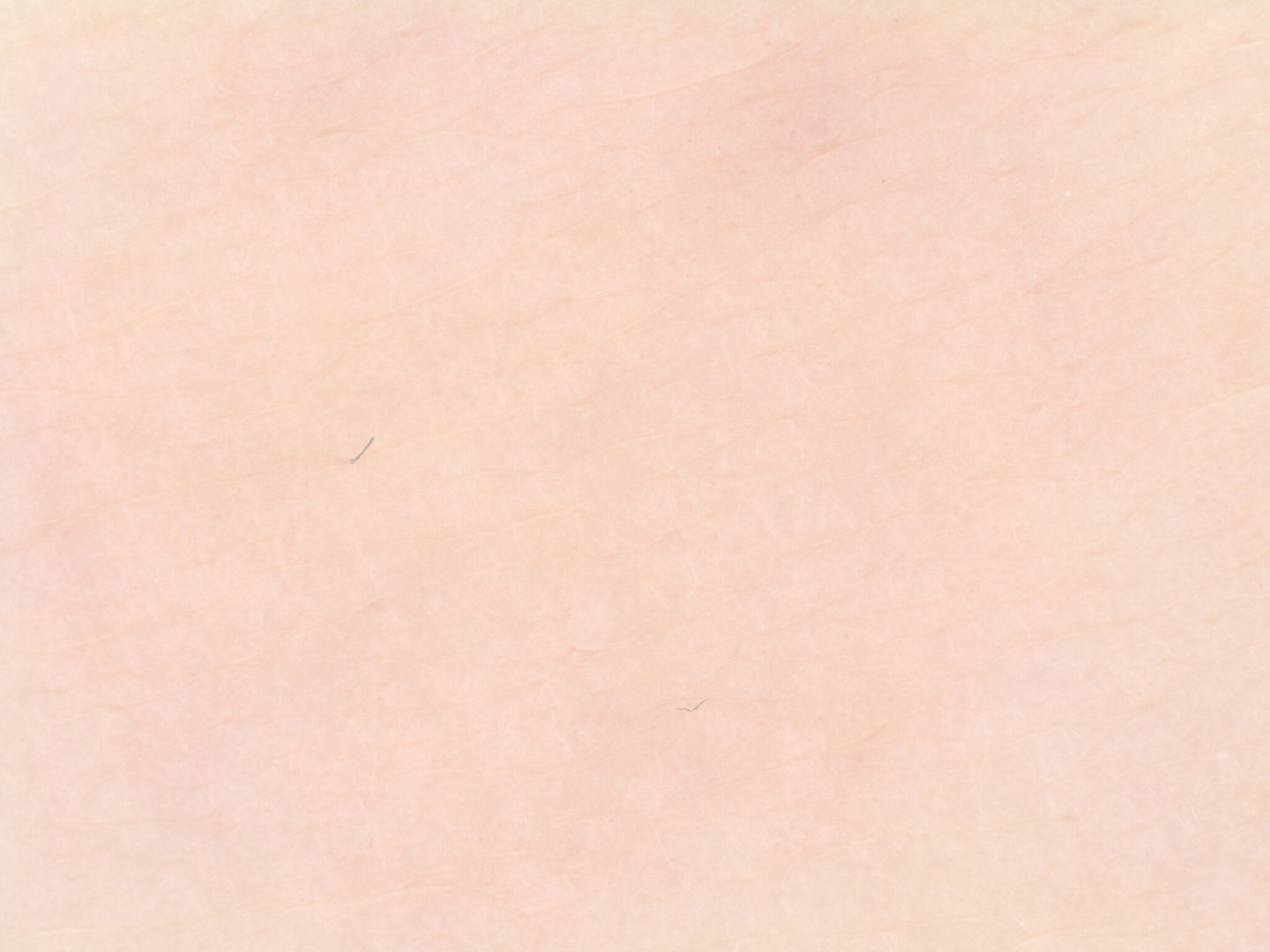 肌の明度、赤み、均質性