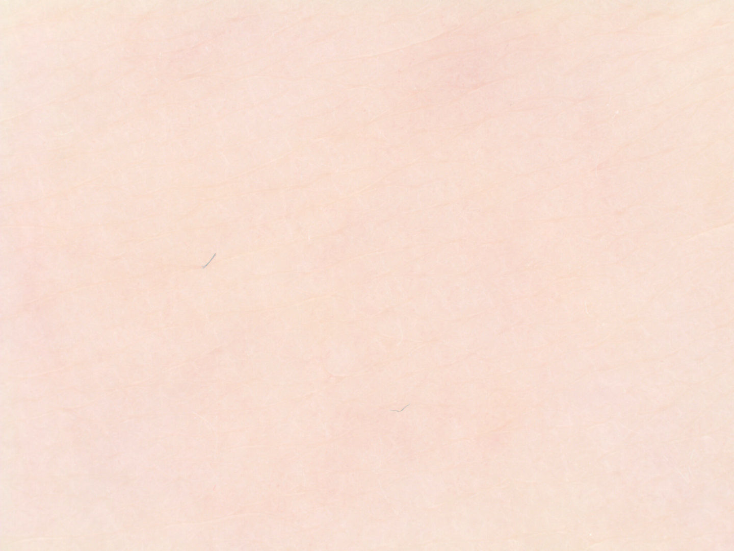 肌の明度、赤み、均質性