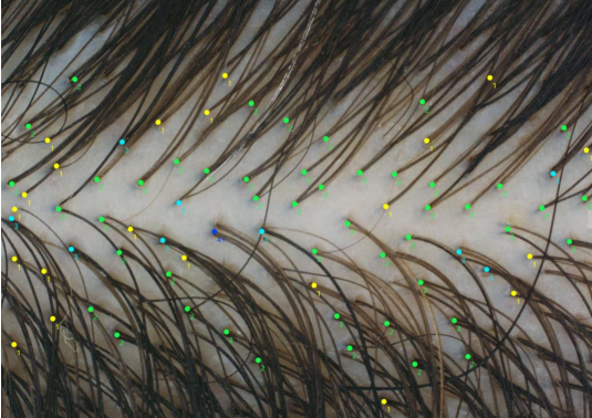 ポータブル水分蒸散計 VapoMeter®