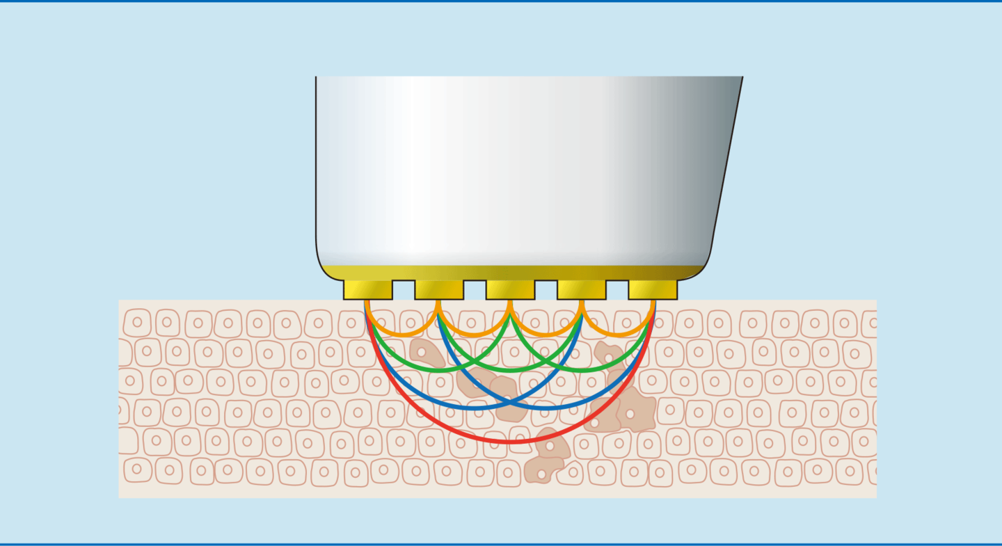 バリアの破壊を予測